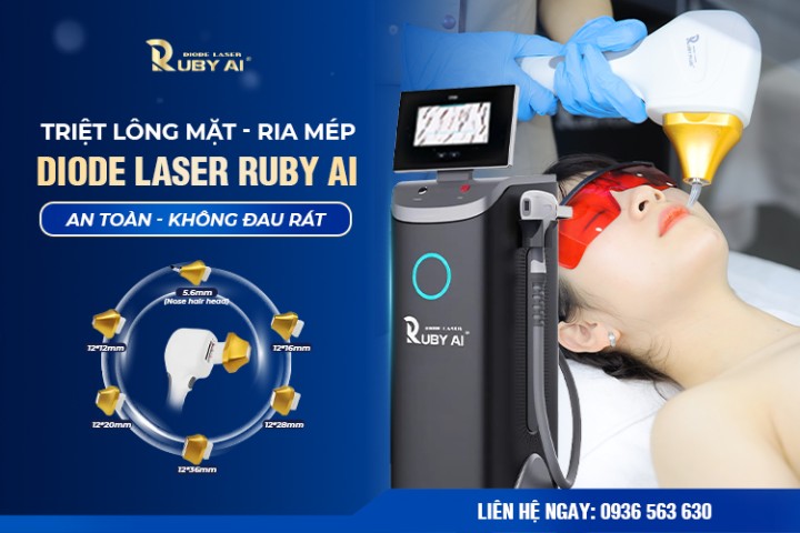 Dịch vụ triệt lông Mặt - Mép - Ria công nghệ Dior Laser Ruby AI